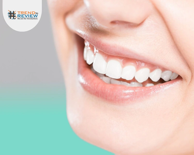 Teeth Whitening in Los Angeles